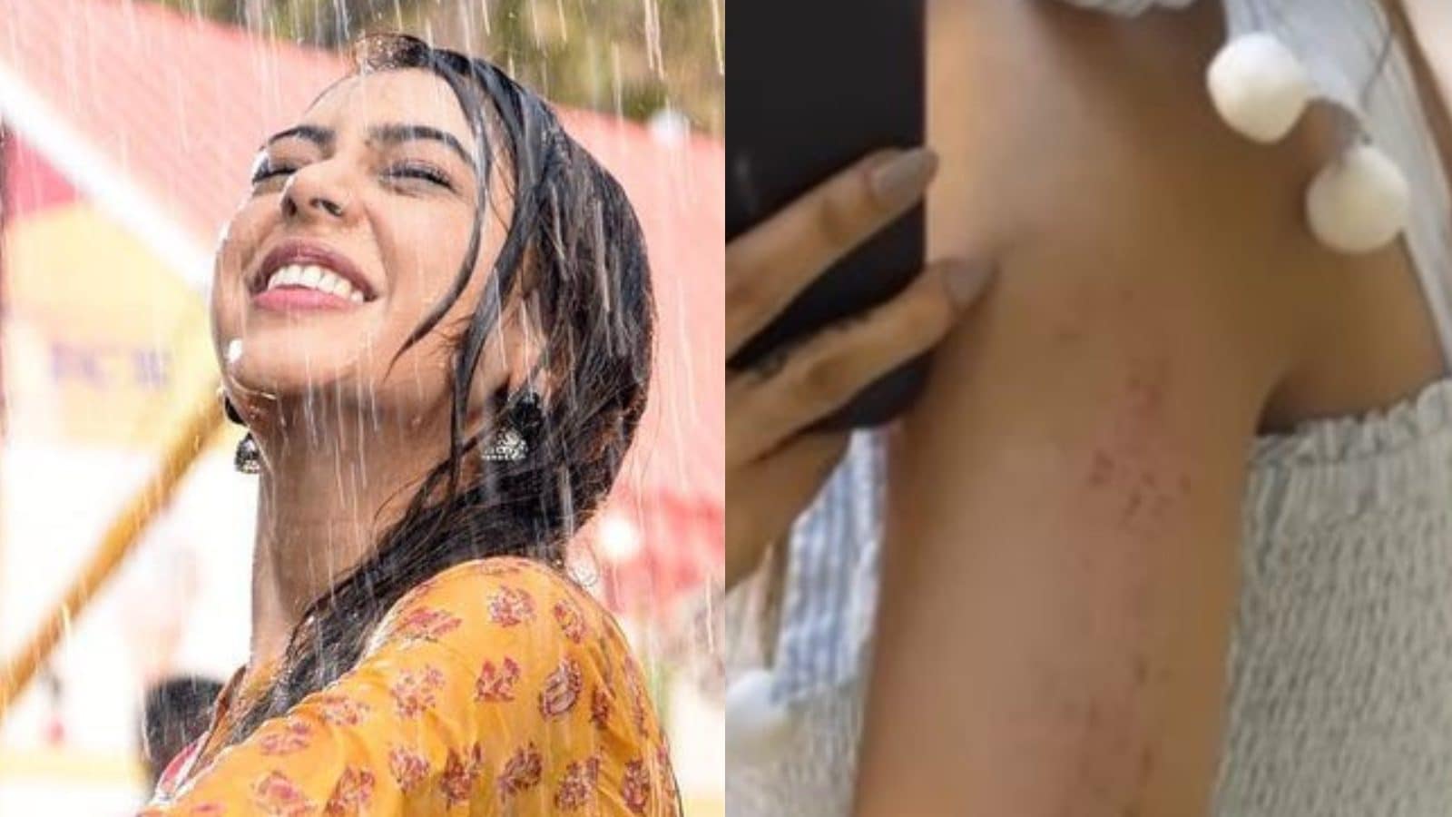 Too Many Oouchies: Niti Taylor Gets Injured While Shooting For Bade Achhe Lagte Hain 2
