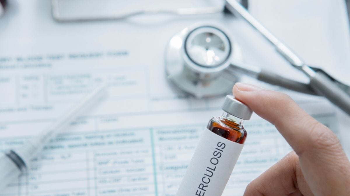 Centres Mathematical Model Shows Tuberculosis Cases, Deaths Lower Than Yearly WHO Estimates