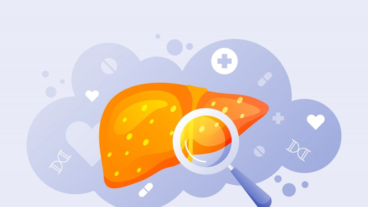 World Liver Day 2023: All You Need To Know About Liver Cirrhosis