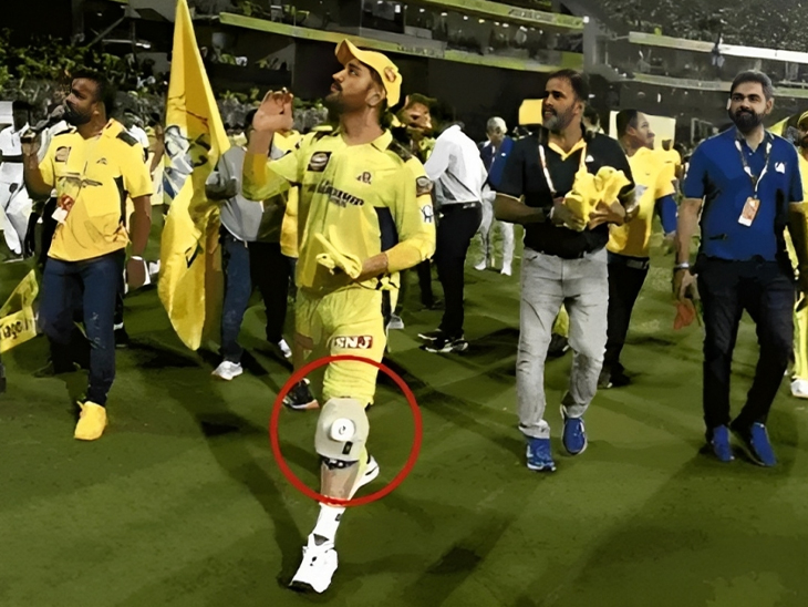 CSK CEO Kasi Vishwanathan said about Dhoni: Mahi never complained about his knee problem